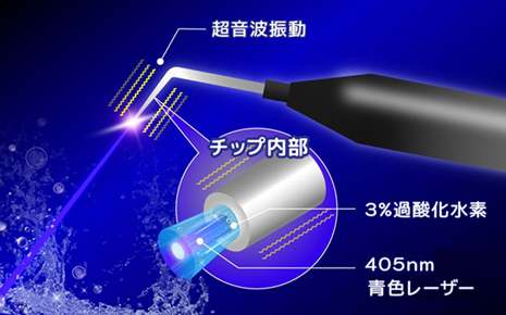 ブルーラジカル