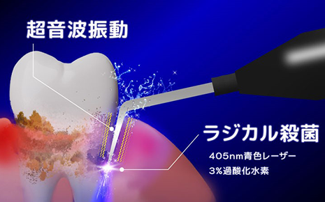 ブルーラジカル